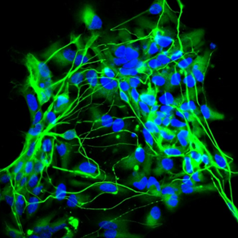 Microscopic view of neural cells with green stained nerve fibers and blue stained nuclei against a black background.