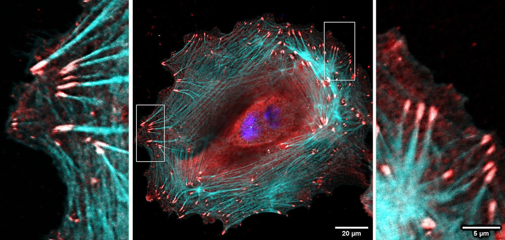 Human keratinocytes on a 2D biointerface thumbnail