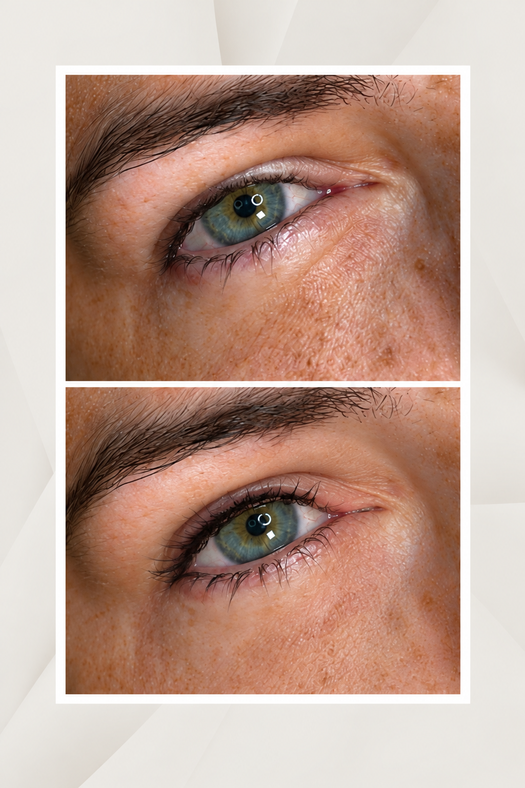 Close-up van een menselijk oog met blauwe iris, weergegeven in twee vergelijkbare foto's, één  voor en na foto,