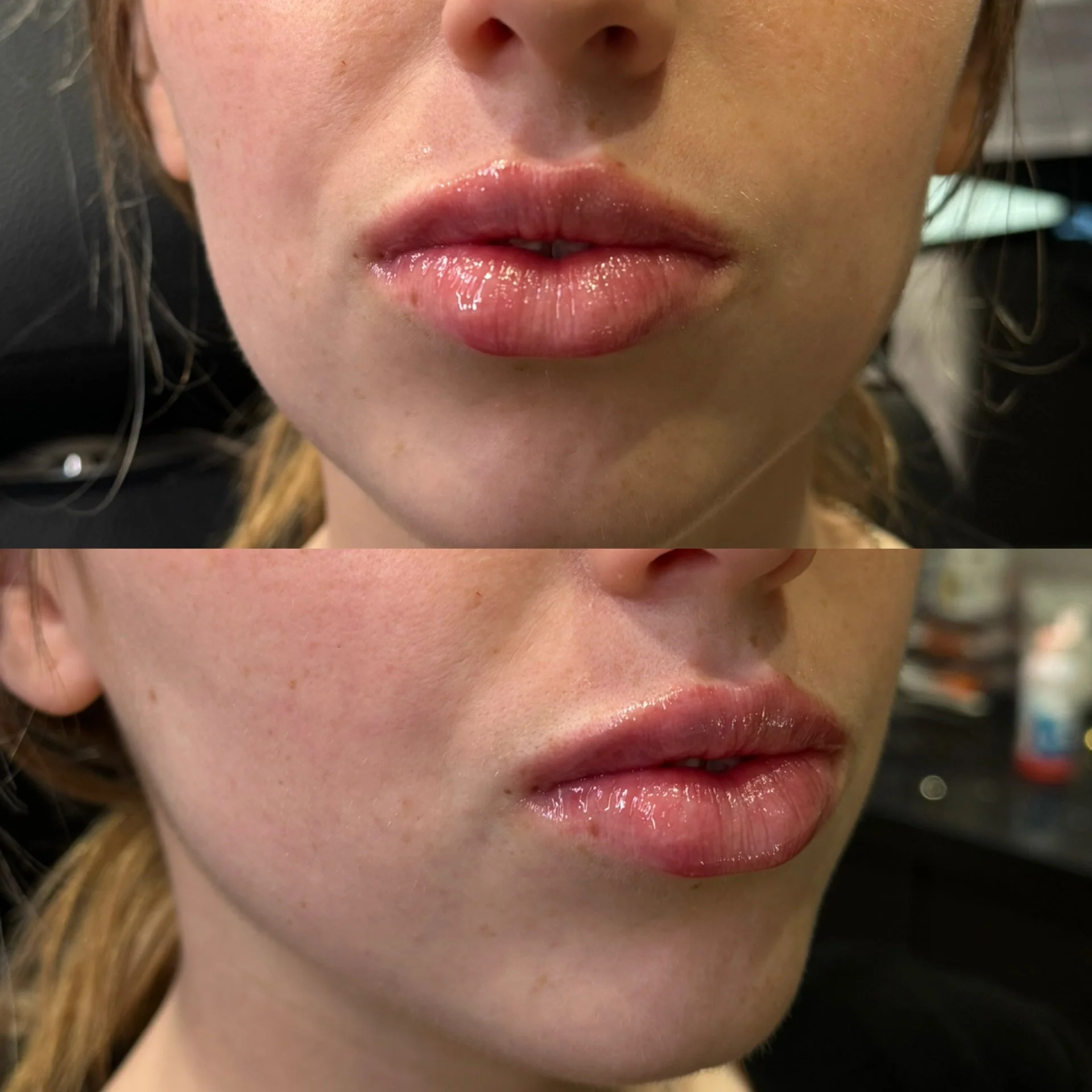 Close up of naturally enhanced full lips.