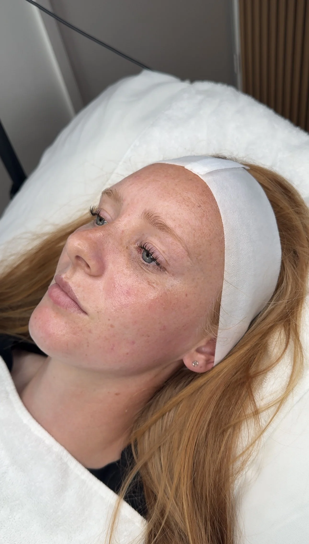 A woman with red hair lying on a hospital bed, wearing a white headband, in a medical setting.
