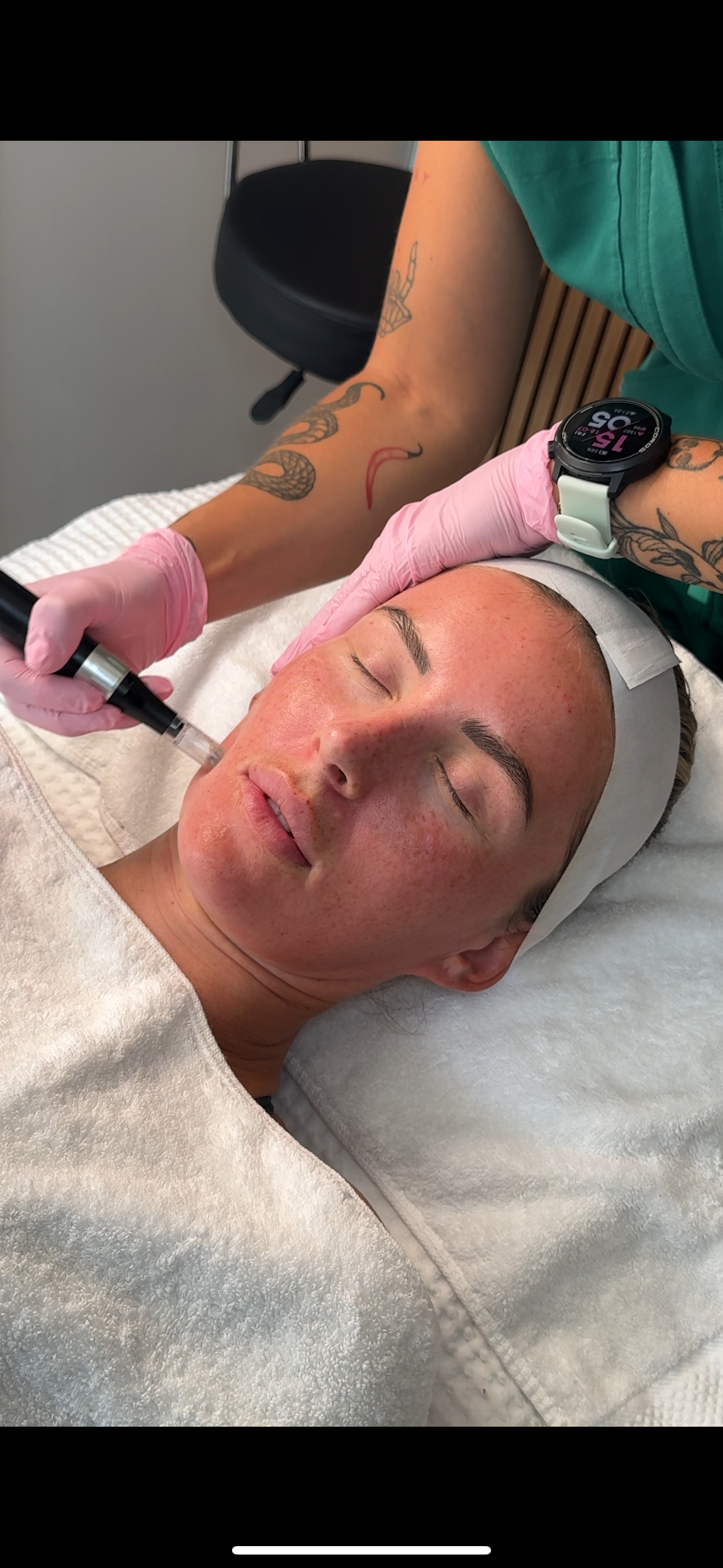 A woman receiving a cosmetic facial treatment with a device held by a professional wearing pink gloves. The woman has tattoos and is lying on a treatment bed, with her eyes closed.
