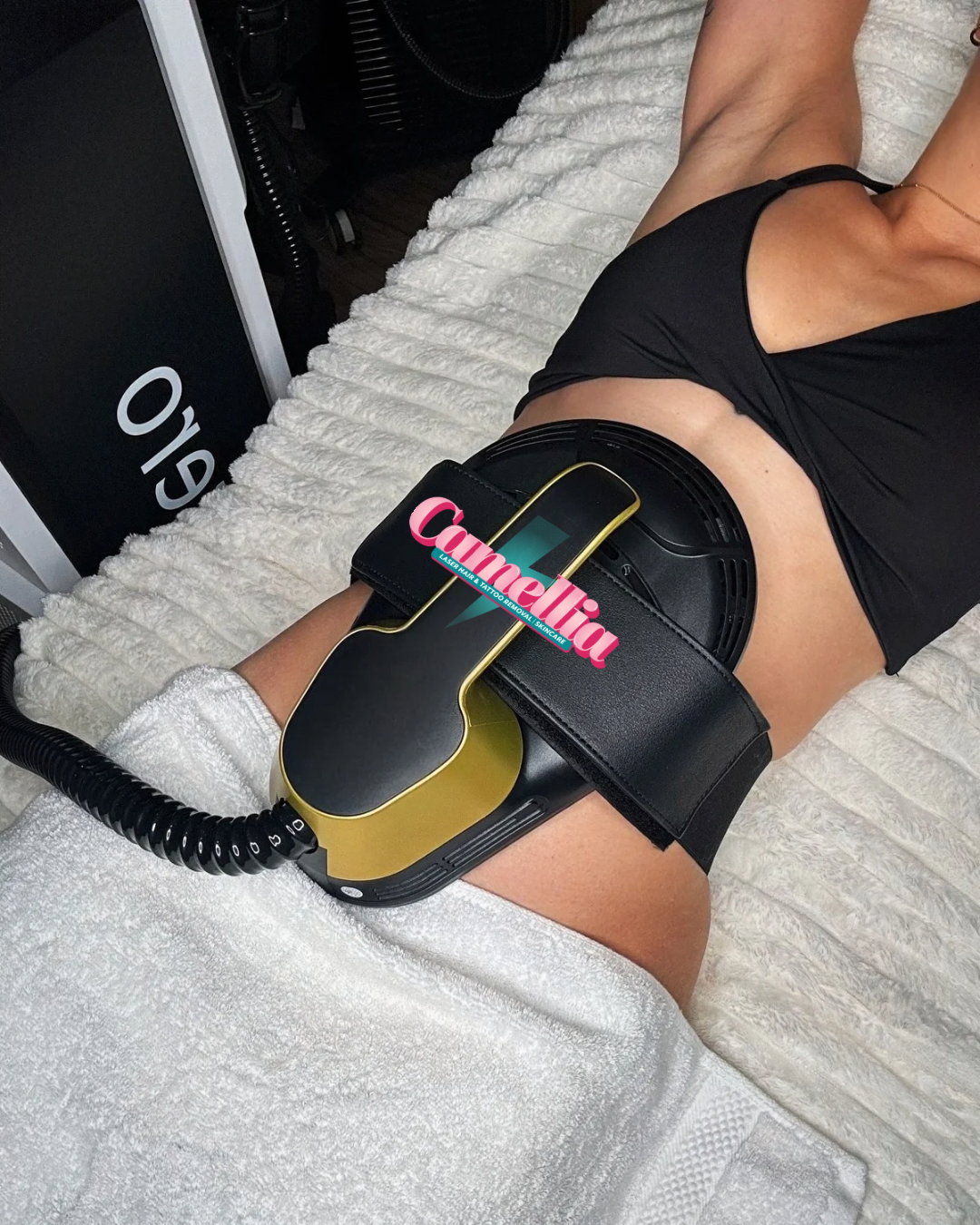 A woman lying on a bed having a laser hair removal treatment on her thigh.