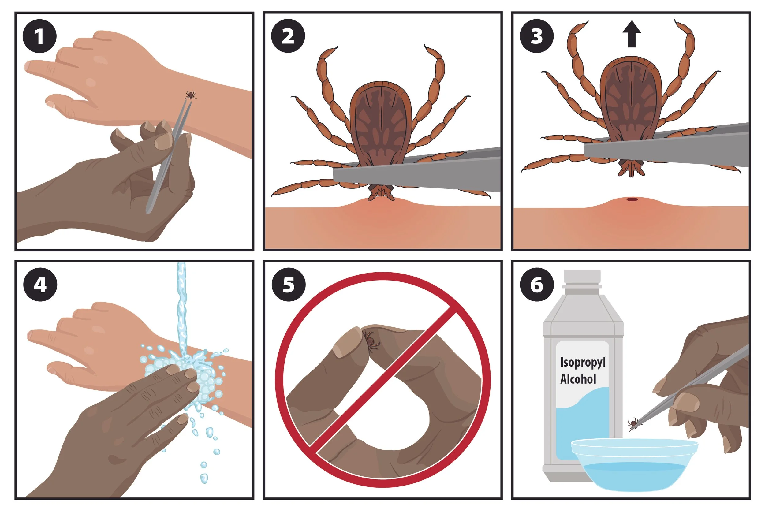 How to Remove a Tick