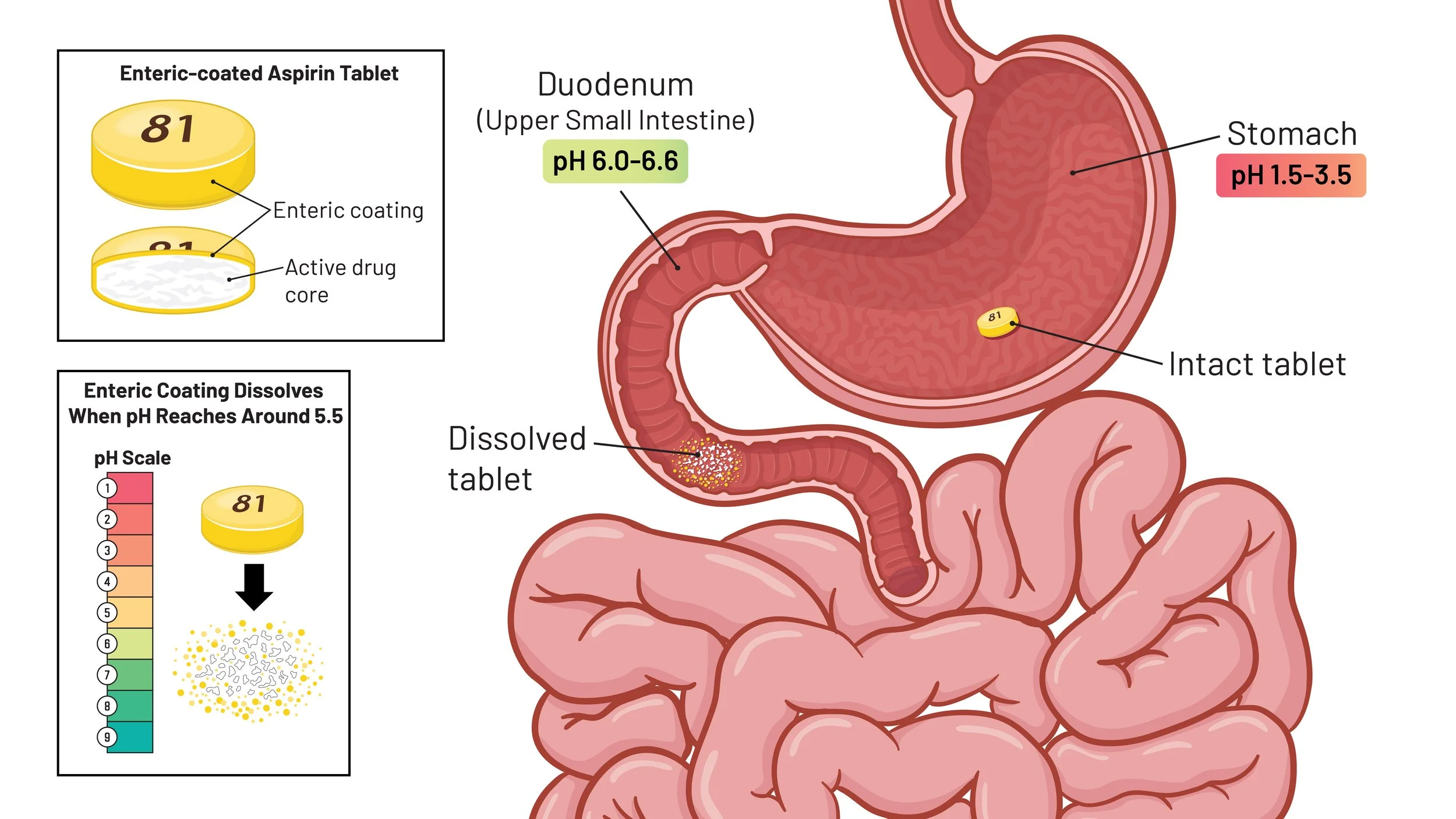 Enteric-Coated Tablet in the Digestive Tract