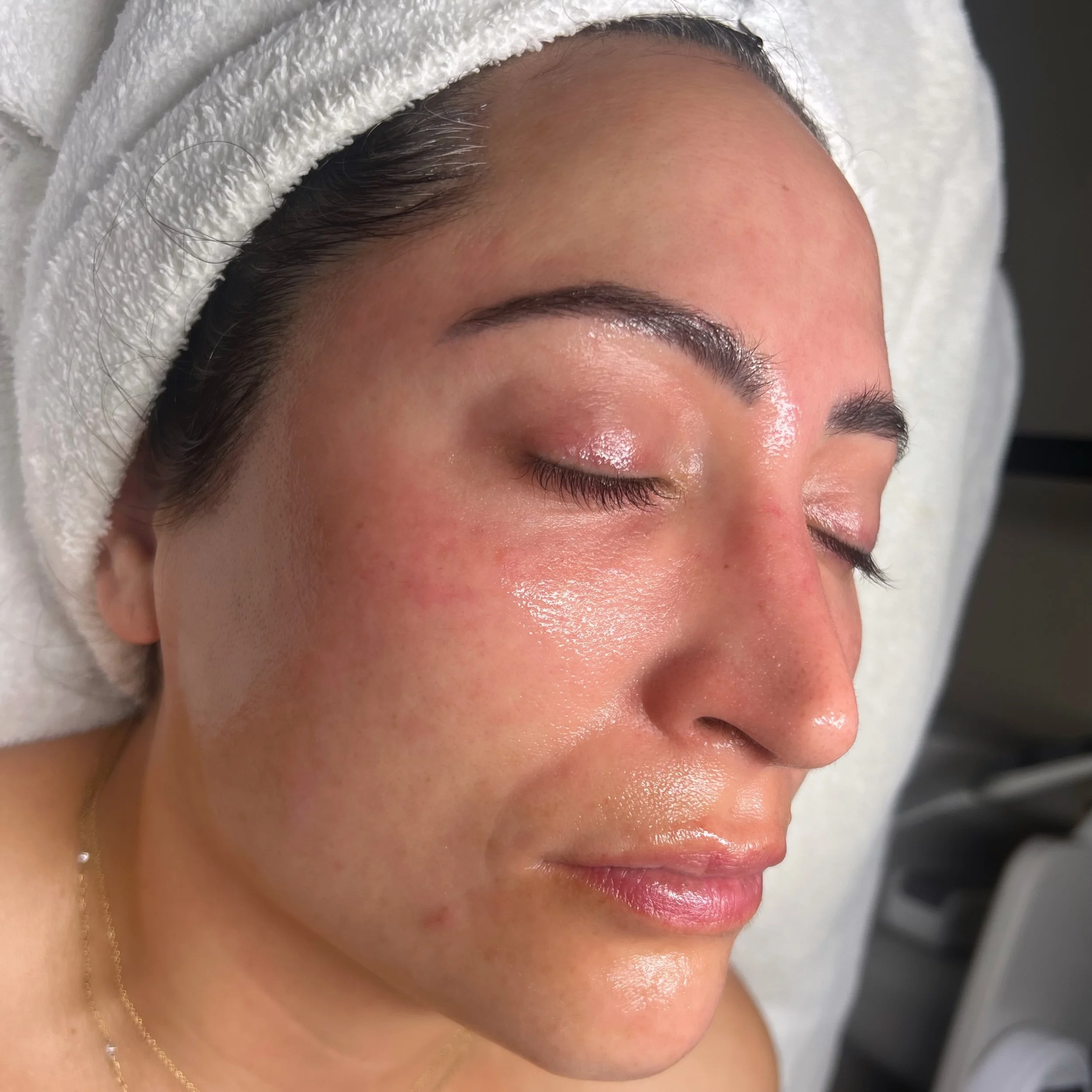 Nothing like that post @hydrafacial glass skin 🧊 #esthetician #glowyskin #glassskin