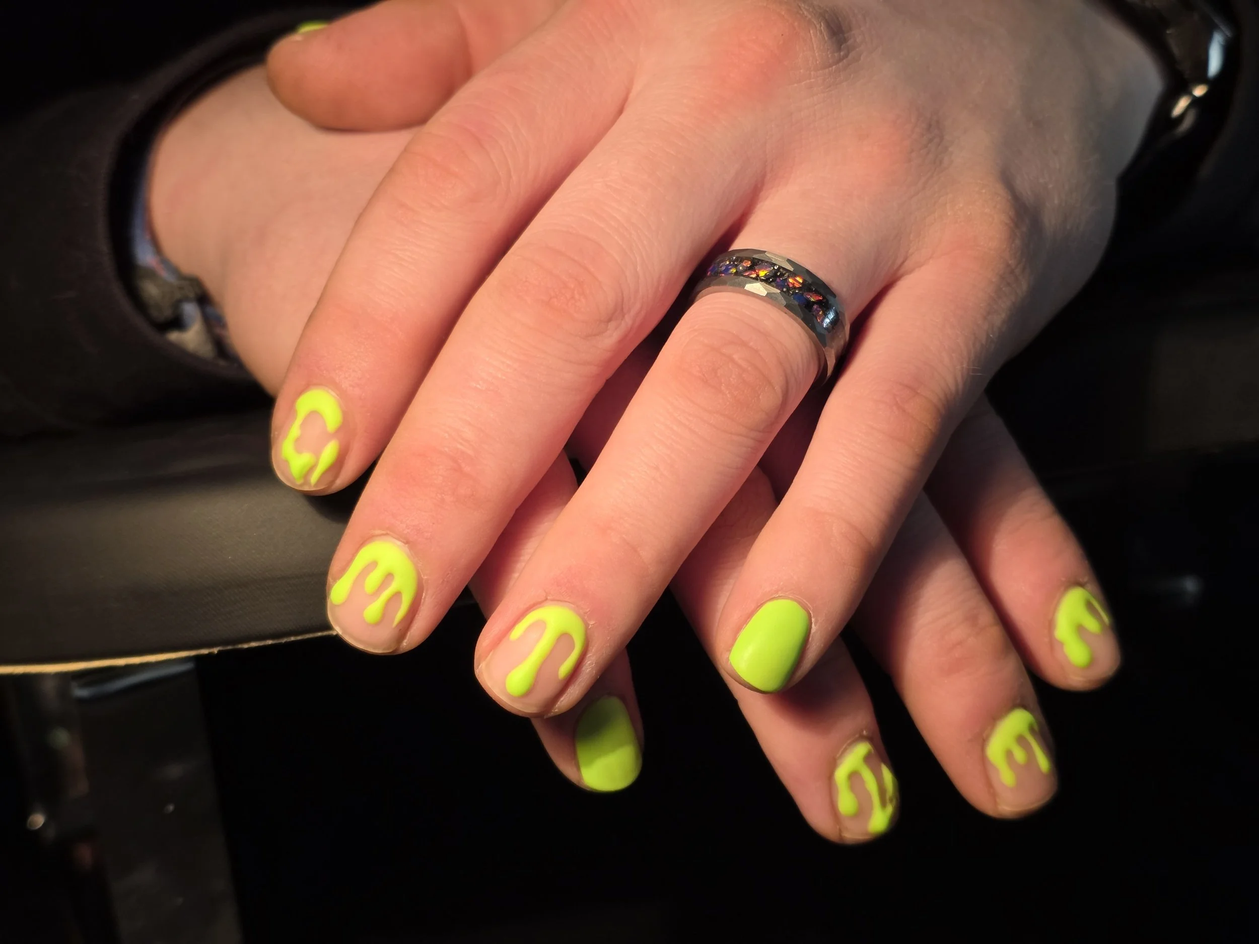 Close-up of a person's hand with neon yellow nails and a silver ring with colorful stones. The person's hand is resting on a black surface.