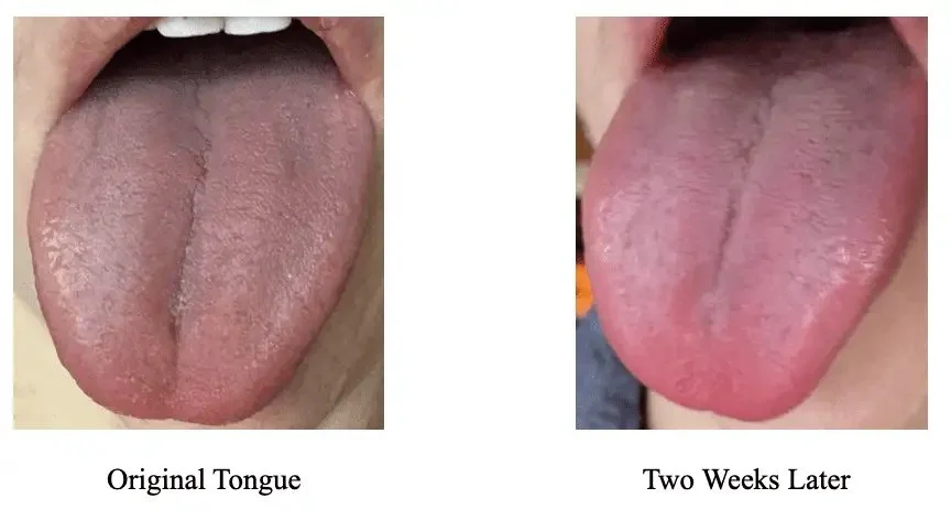 Telehealth Case Studies: Herbal Diagnosis WORKS!