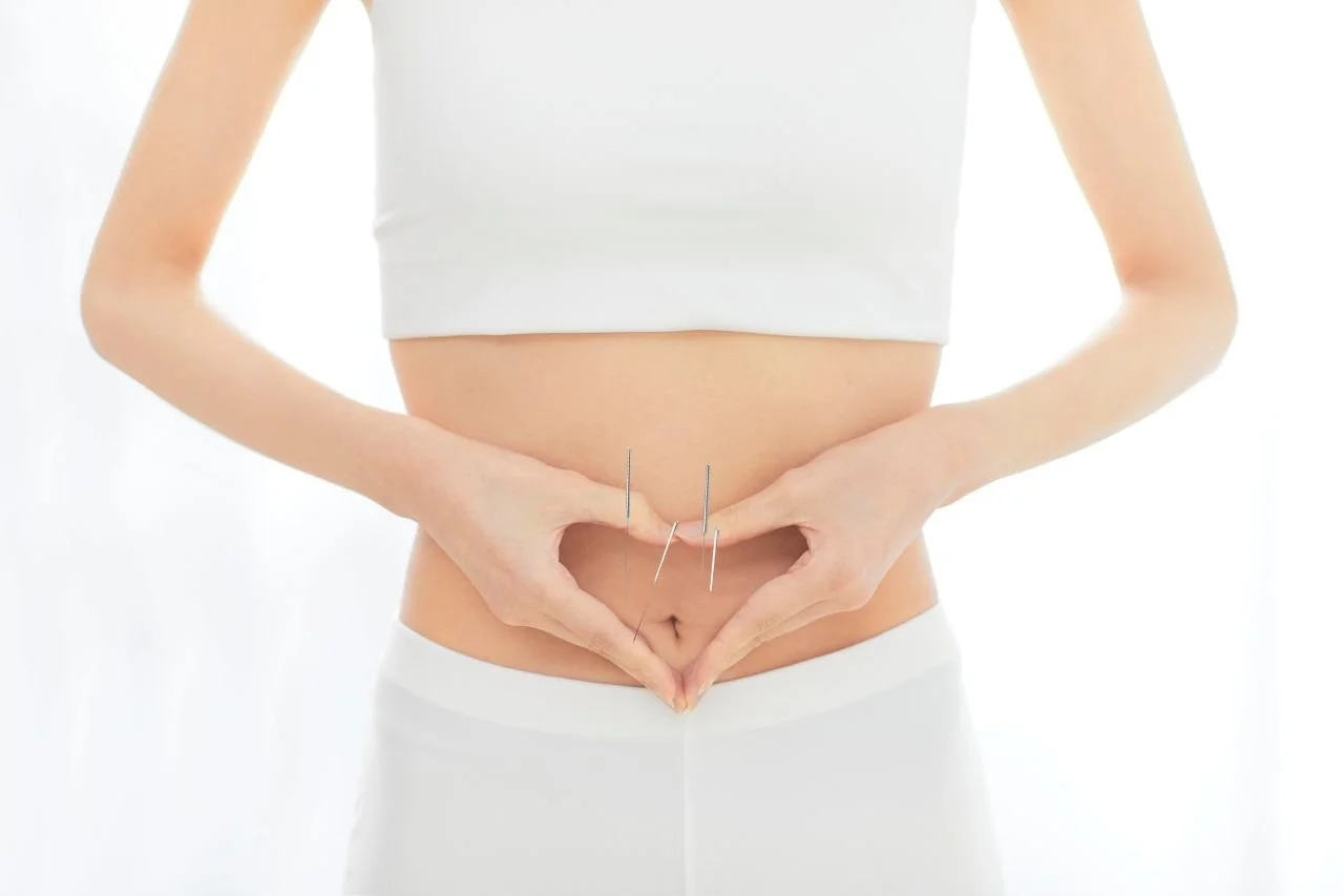 When to Start Acupuncture Before IVF: A Smarter Fertility Timeline