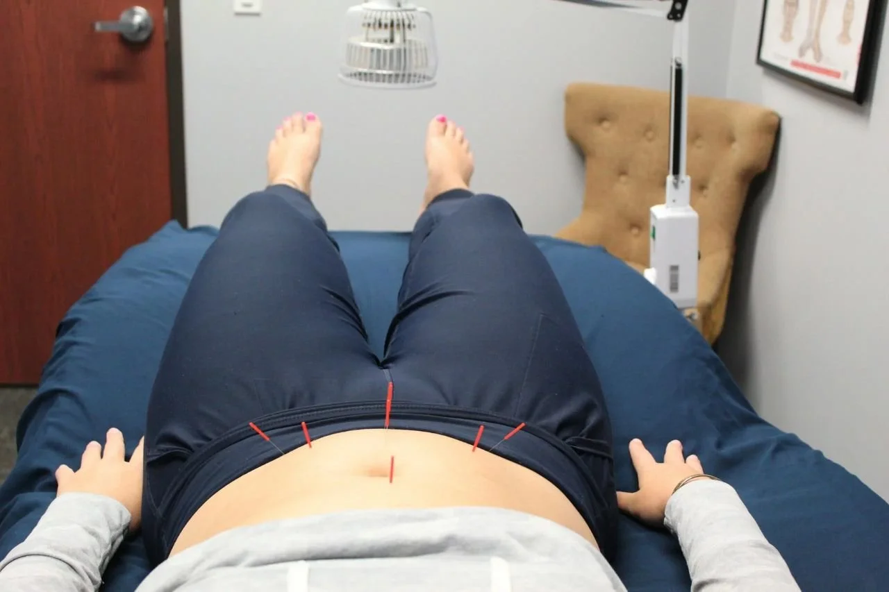 Hormonal Health and Fertility: How Acupuncture May Support Whole-Body Wellness