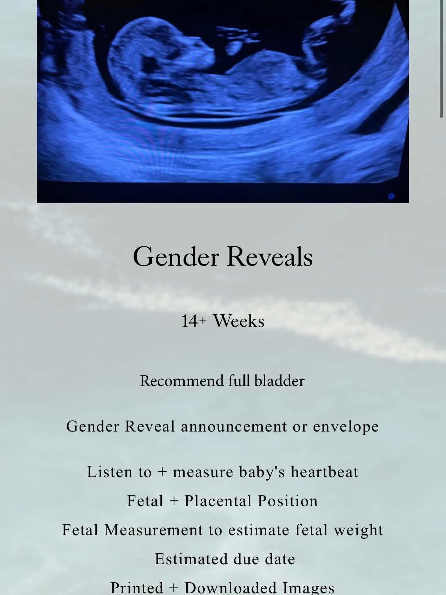 Just a reminder I offer gender reveals! Starting at 14 weeks🫶🏼 book yours now! #ultrasound #mobileultrasound #socal #pregnant #genderreveal