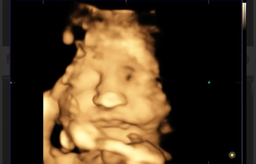 3rd trimester 3D scans are a must!! Cheeks for daysss!! Book yours now 🫶🏼🍼🤰 #pregnancy #mobileultrasounds #ultrasounds #sandiego #camppendletonwives