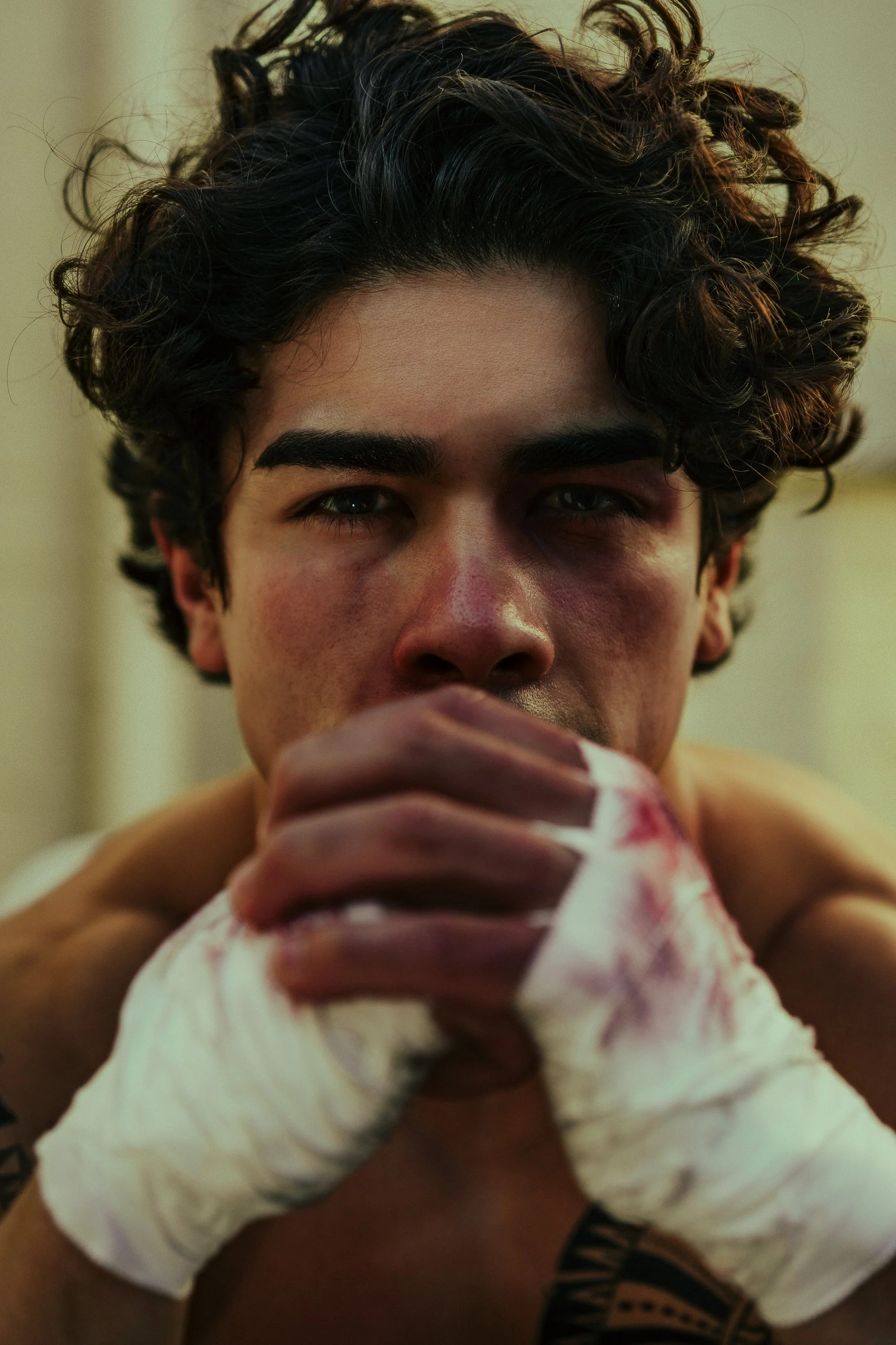 Close-up of a young male athlete with messy curly hair, bruised face, and clenched hands wrapped in white tape, looking intensely at the camera.