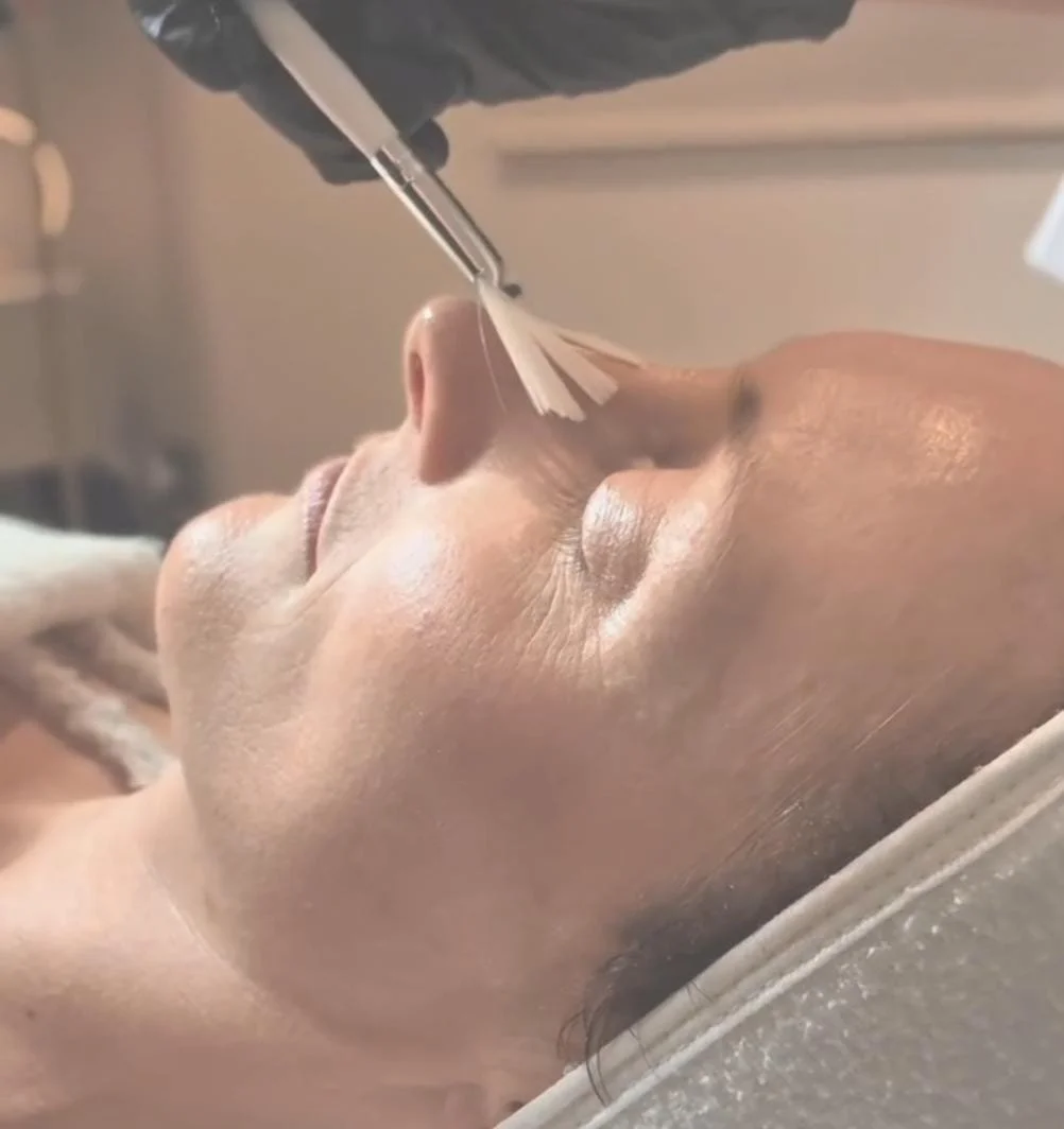 ZO Medical Grade Skin Peels And Bespoke Facials.