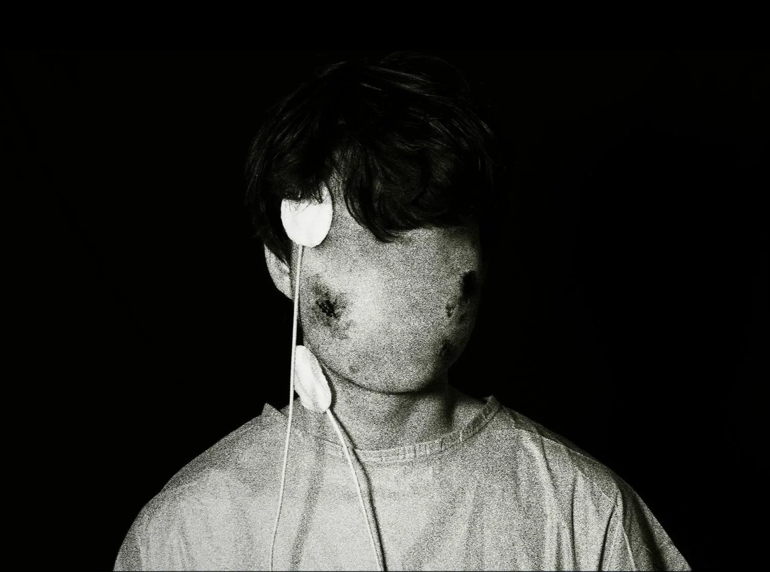 A black and white photo of a young boy with messy hair wearing a shirt, with a large flower covering one eye, and the other eye obscured by darkness or shadow, against a dark background.
