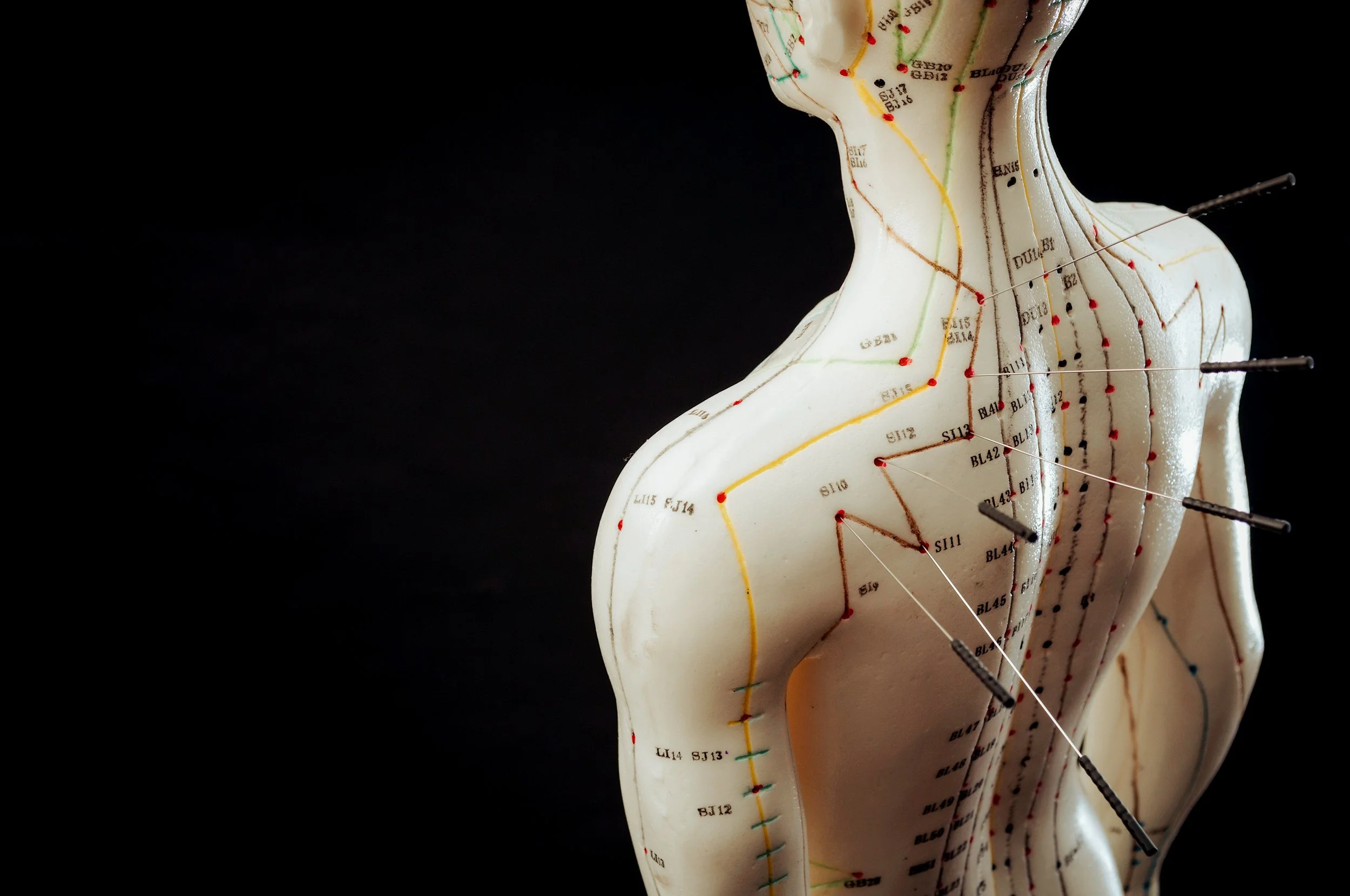 An anatomical model of a human torso, showing acupuncture points and meridian lines on the back. Several acupuncture needles are inserted into the model at various points.