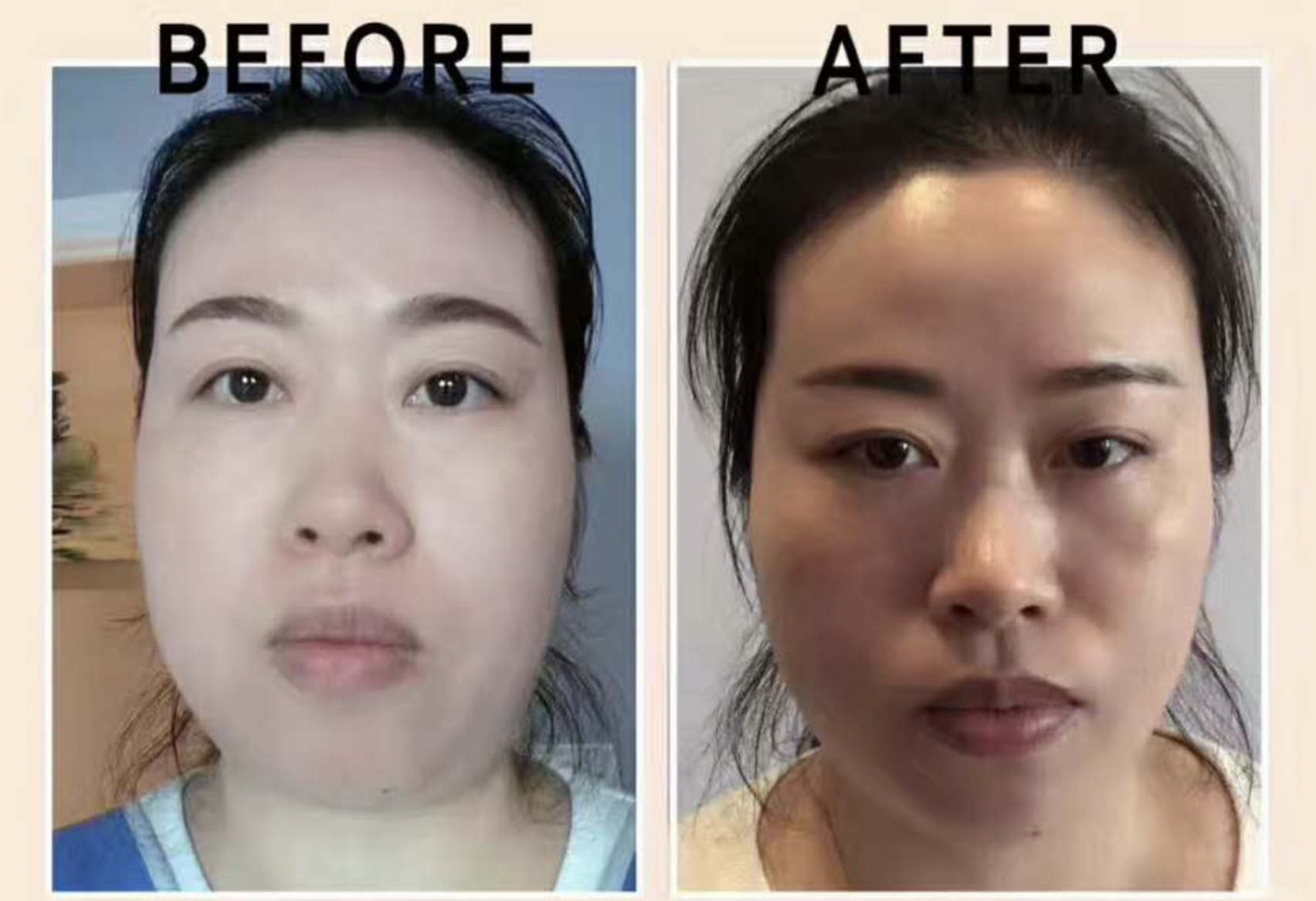 Side-by-side comparison photo of a woman before and after skincare treatment, with the left labeled 'BEFORE' and the right labeled 'AFTER'. The woman has clear skin in the before image, and slightly more radiant skin with a different expression in the after image.