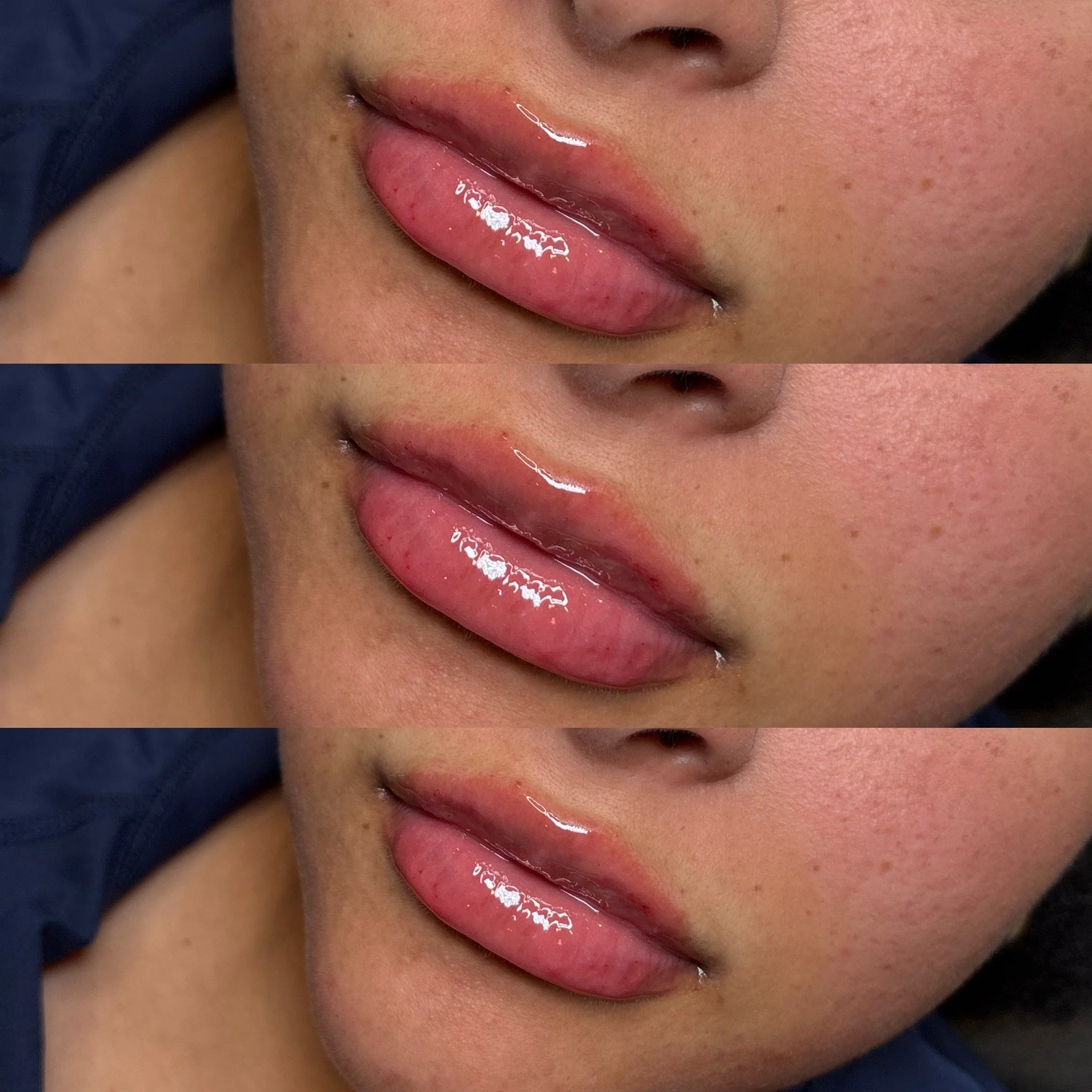 Close-up of a person's lips with a shiny, pink gloss, and slightly visible red skin around the lips, with part of the person's face and skin visible.