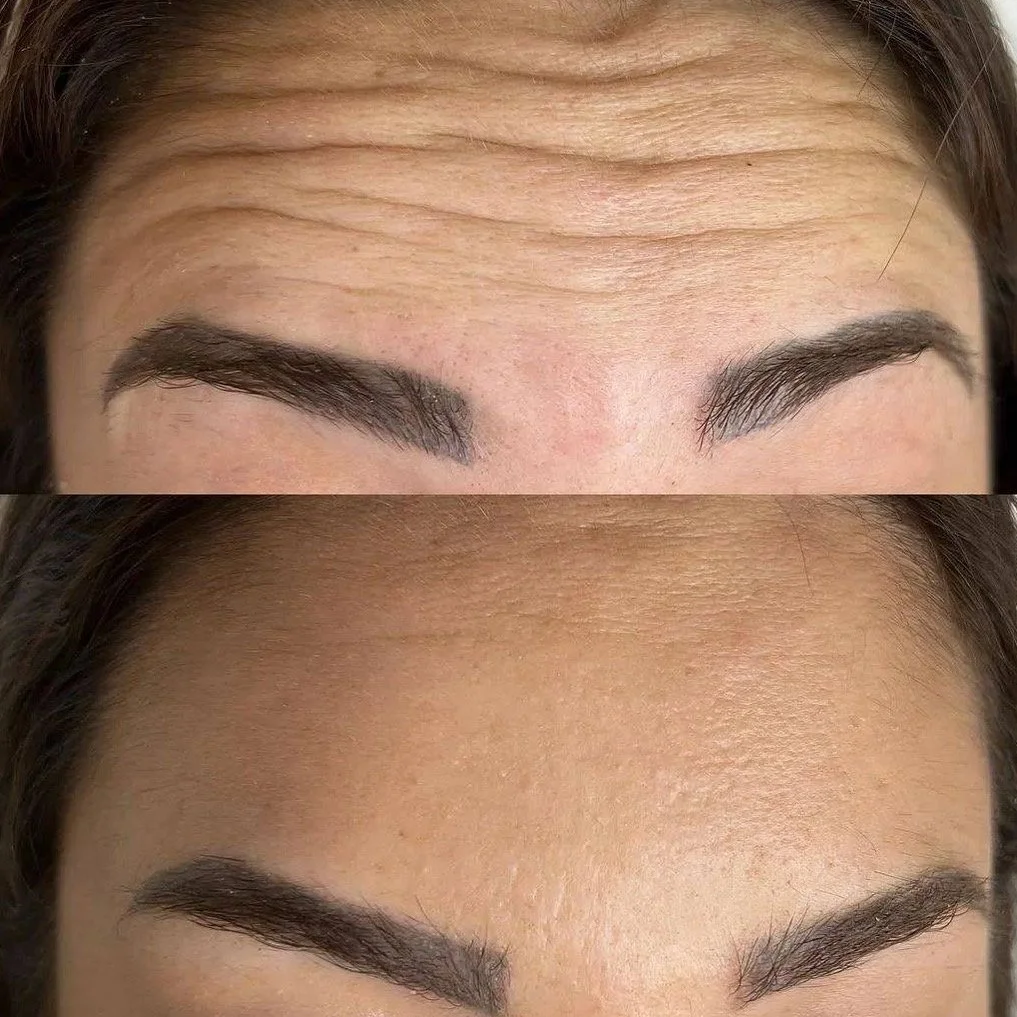 Close-up of a woman with smooth brown skin, natural makeup, and glossy lips, touching her face gently with her left hand.