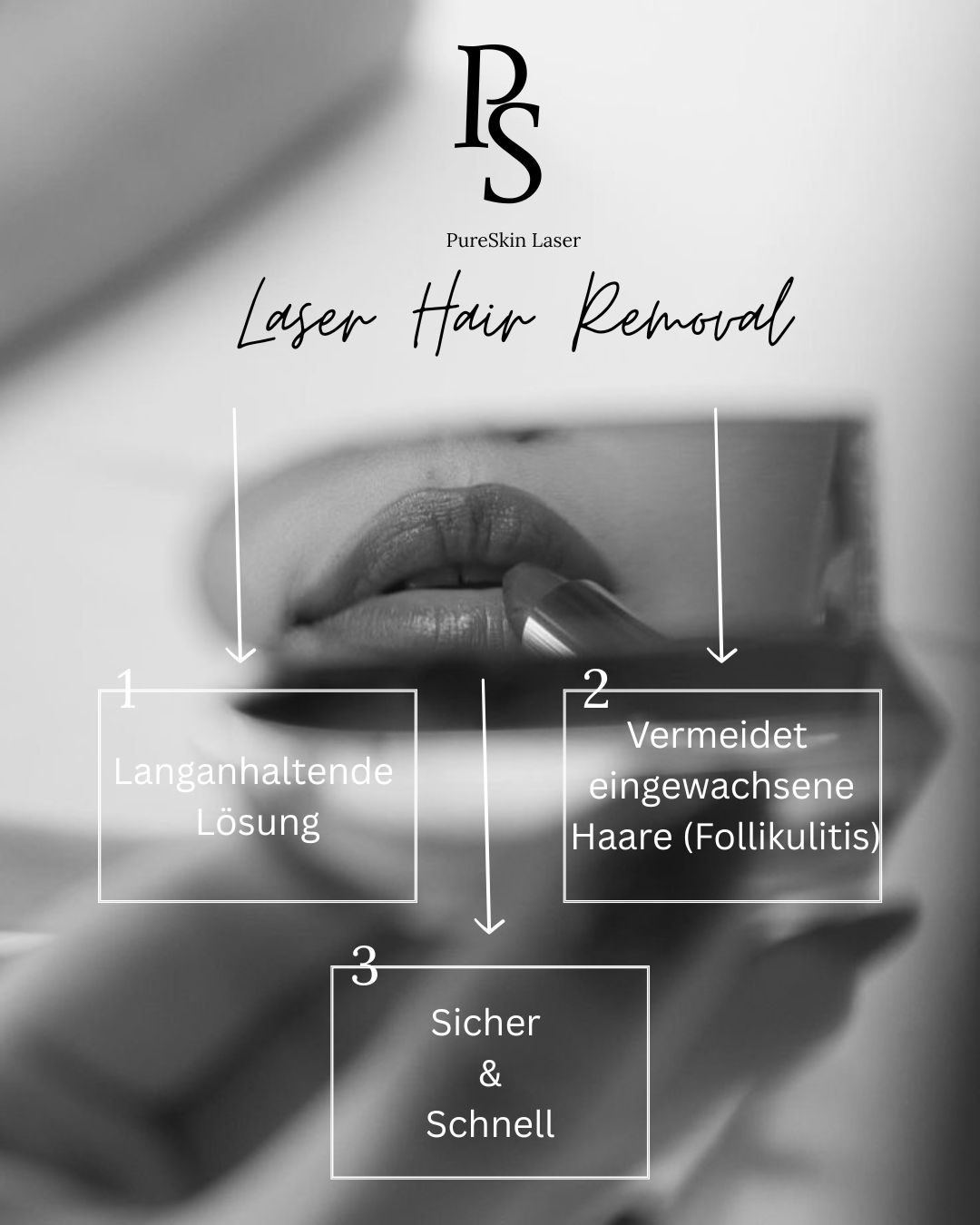 Schwarz-Weiß-Bild einer Frau, die sich die Lippen mit einem Laser entfernen lässt, mit Text-Overlays, die die Vorteile der Laser-Haarentfernung beschreiben, darunter langanhaltende Lösung, Vermeidung eingewachsener Haare (Follikulitis) und schnelle, sichere Behandlung.
