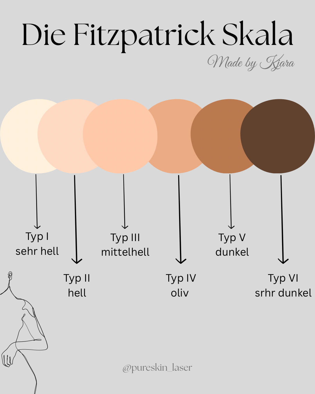 Diagramm der Fitzpatrick Hauttypen mit fünf Farbtönen von sehr hell bis dunkelbraun, jeweils mit Beschreibung: Typ I sehr hell, Typ II hell, Typ III mittelhell, Typ IV oliv, Typ V dunkel, Typ VI schwarz dunkel. Bildquelle: @pureskin_laser.