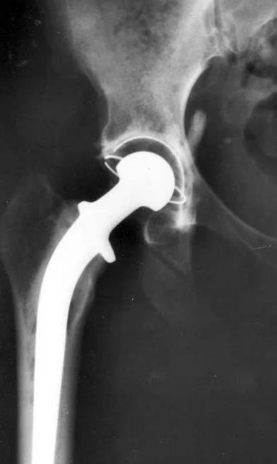 "Joined at the Hip," Surrealism's Centenary, Brooklyn Rail, October 2024