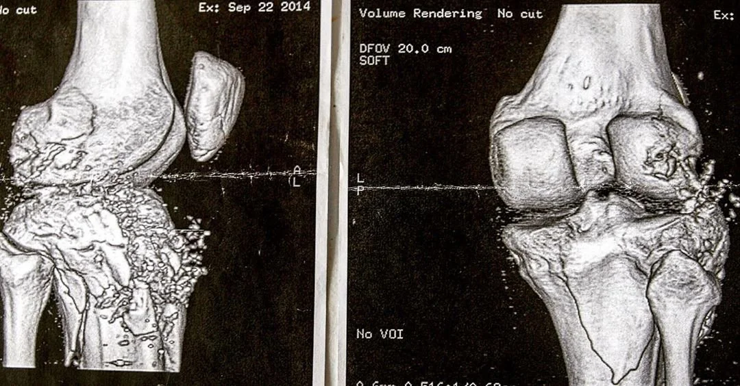 GSW XRAY