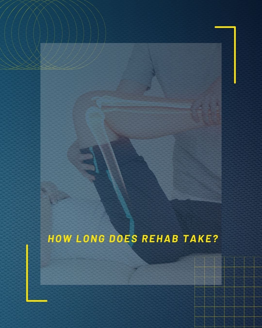 There's no universal timeline.
Your body, history and consistency all matter.

#TrustTheProcess #rehabilitation #ReturnToPlay #AlliedHealth #remedialmassage #ExercisePhysiology #CommunityCare #movebetter #paineducation