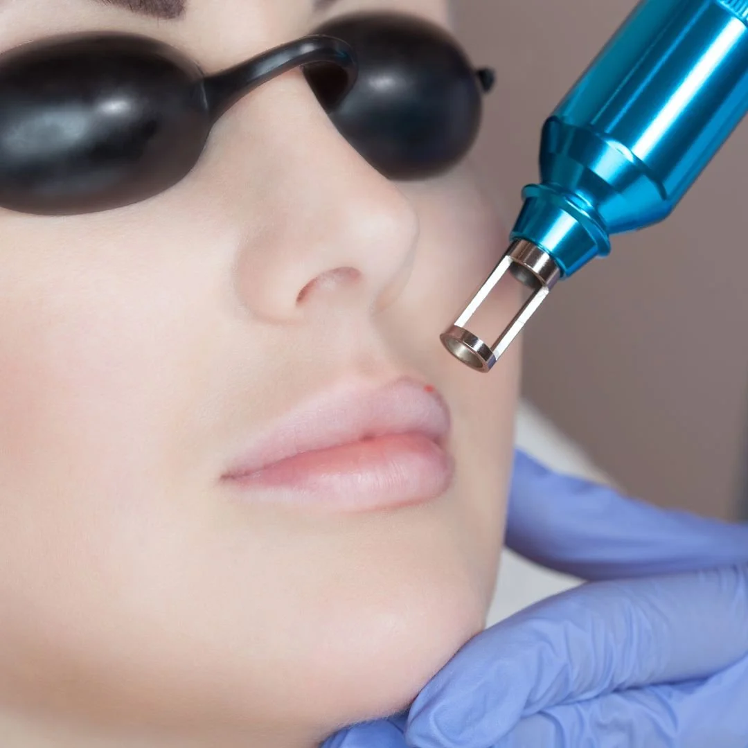 Eliminación de micropigmentación de labios