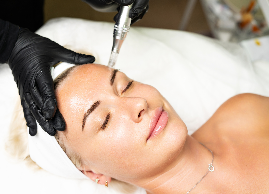 Medspa in Liberty Hill, TX, 78642 | Microneedling Near Me