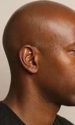 Scalp Maintenance Reset