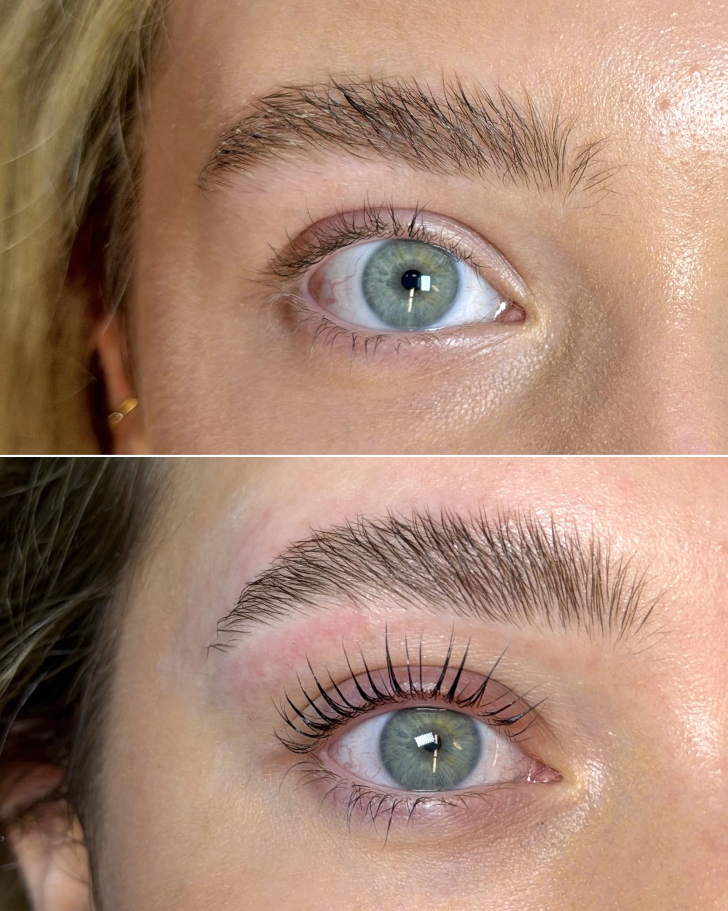 Close-up of a person's eye showing the iris, eyelashes, and eyebrow, with skin texture visible around the eye.