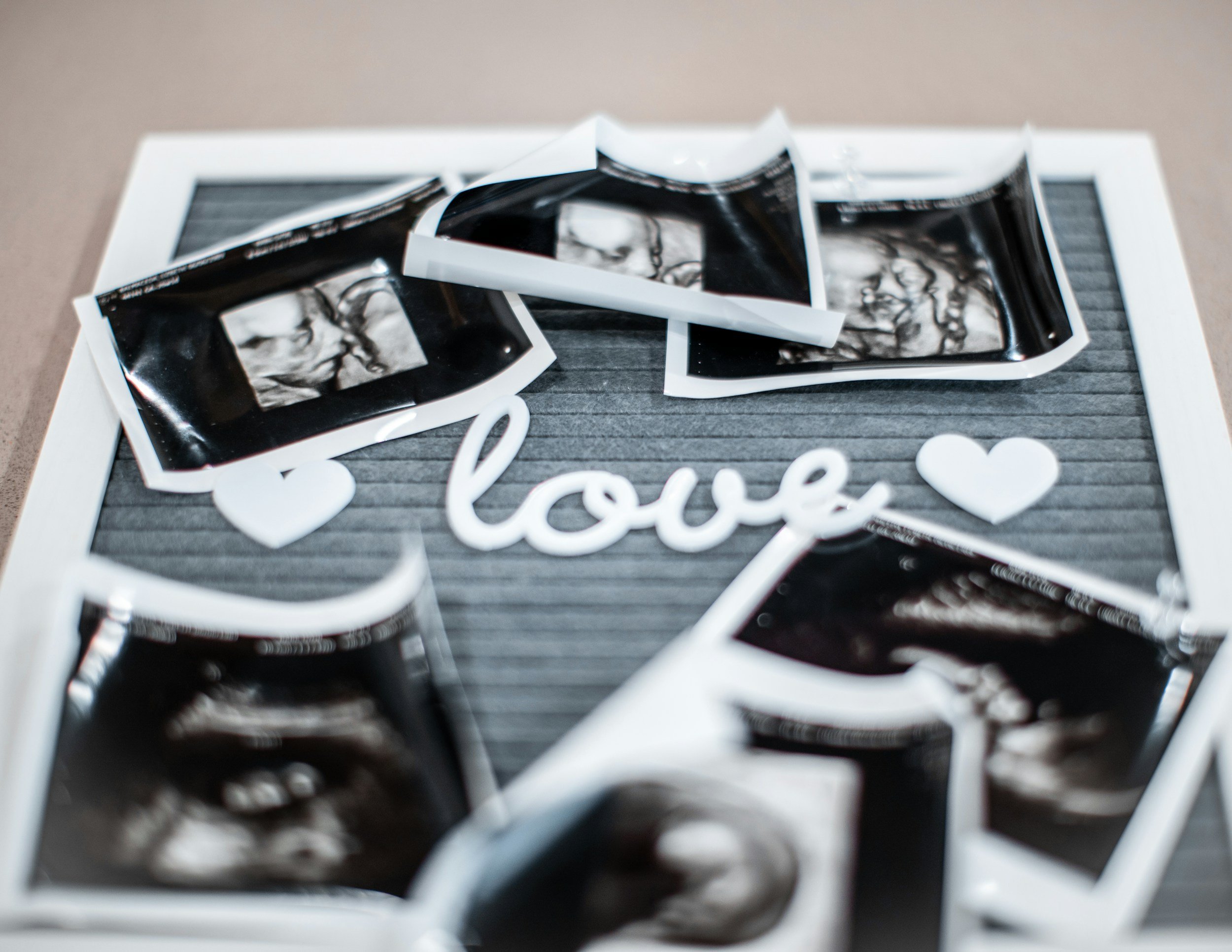 Close-up of several ultrasound printouts on a table, with the word 'love' and heart shapes in front.
