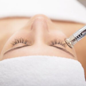 WEDNESDAY MINI MICRODERMABRASION