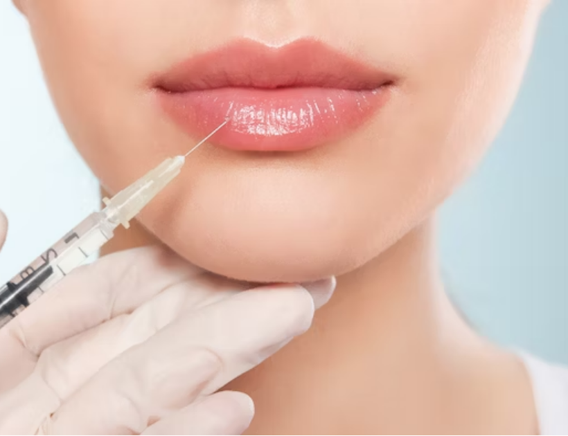 JUVÉDERM® ULTRA + LIP FLIP!