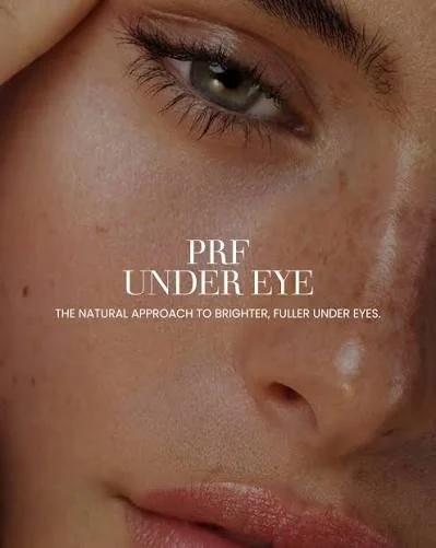 Platelet-rich fibrin (PRF) under-eye treatment