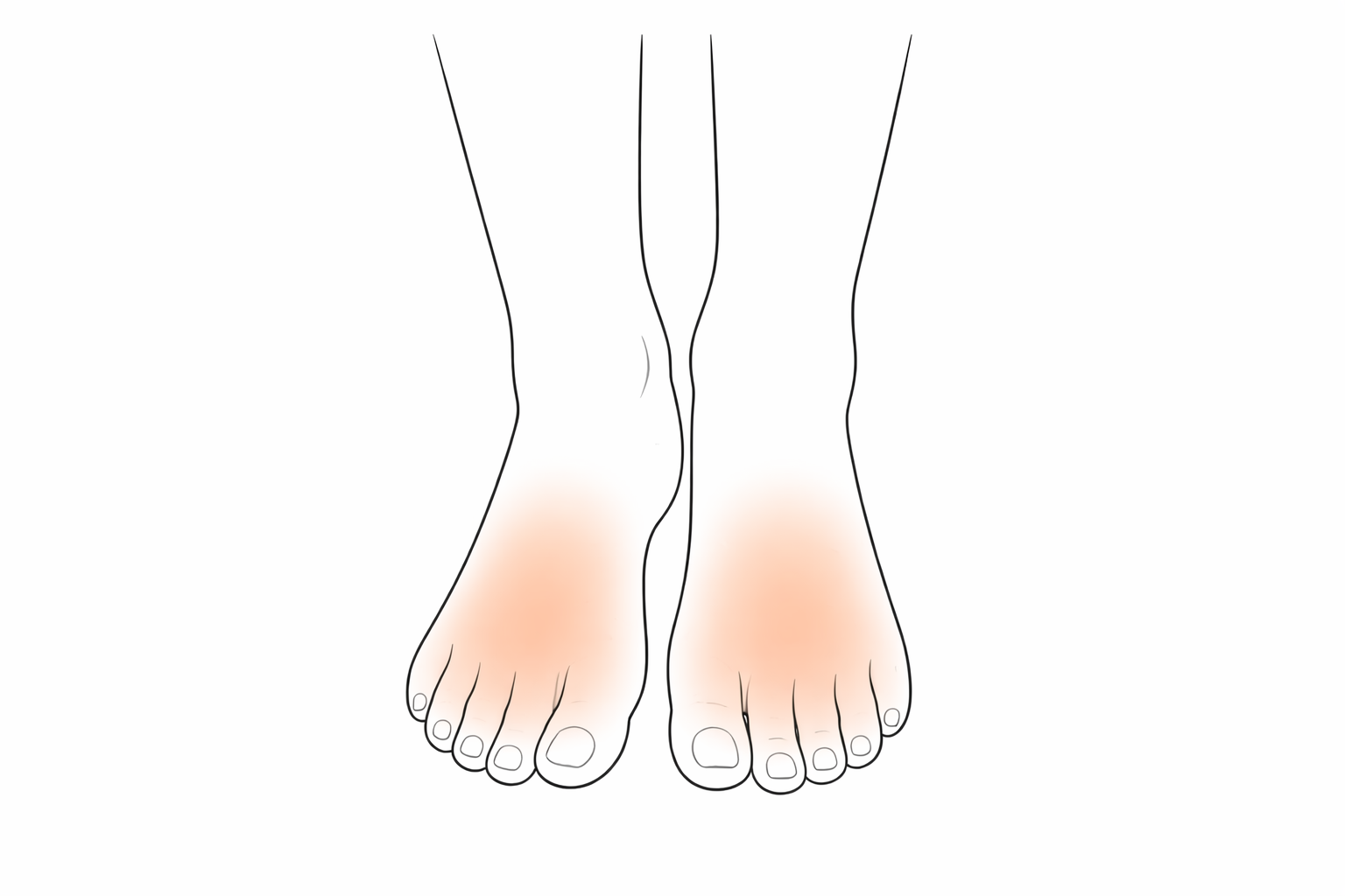 Tops of Feet + Toes