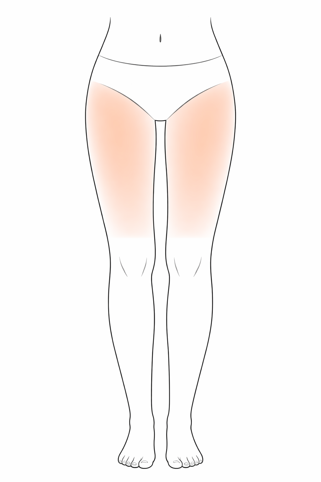 Upper Leg (Both)