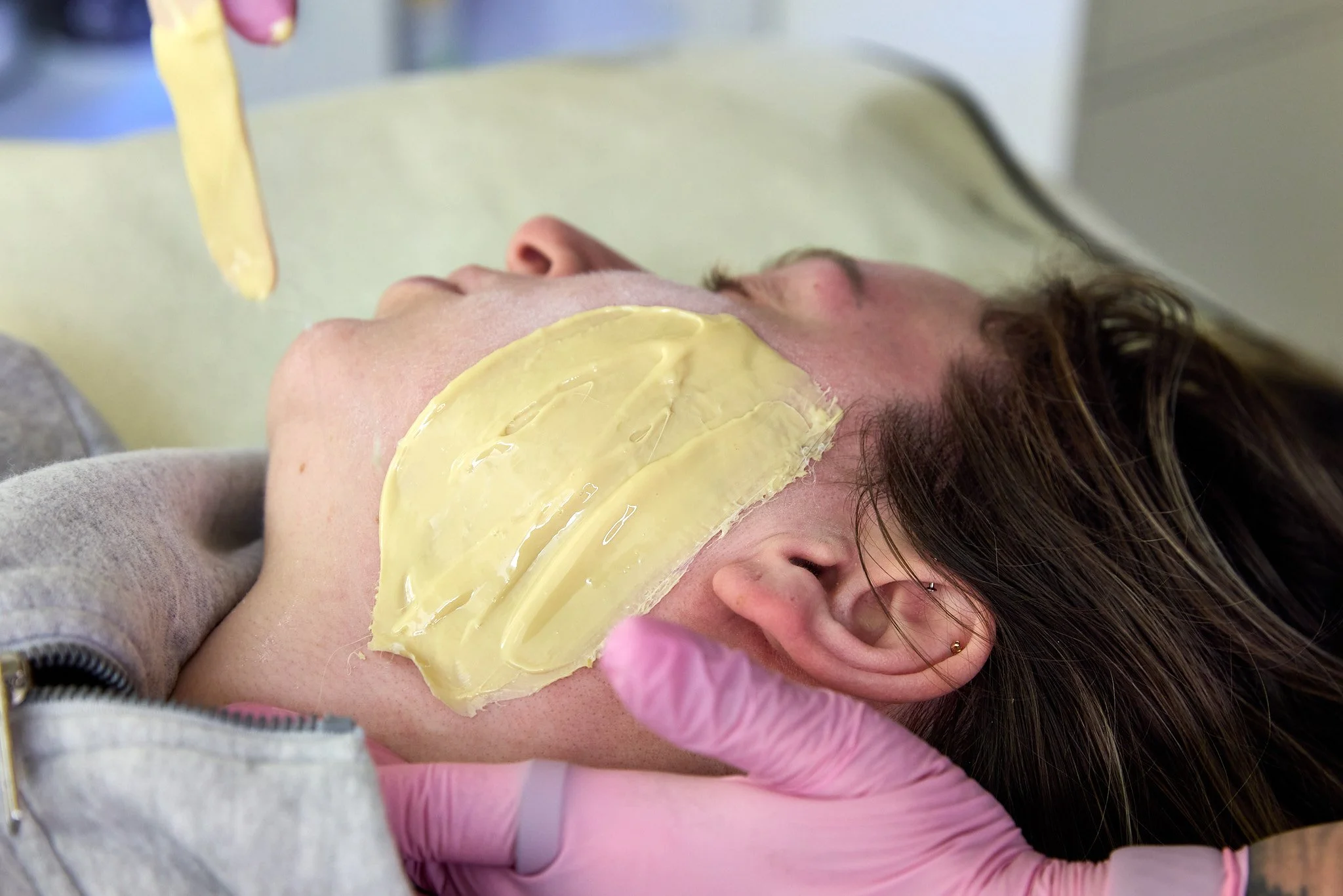 A client receiving a wax treatment on her cheek.
