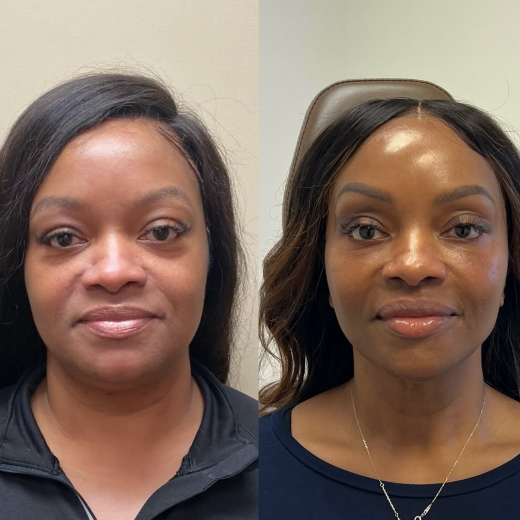 Comparison of a woman before and after makeup and skincare, showing improvements in skin tone, texture, and appearance.