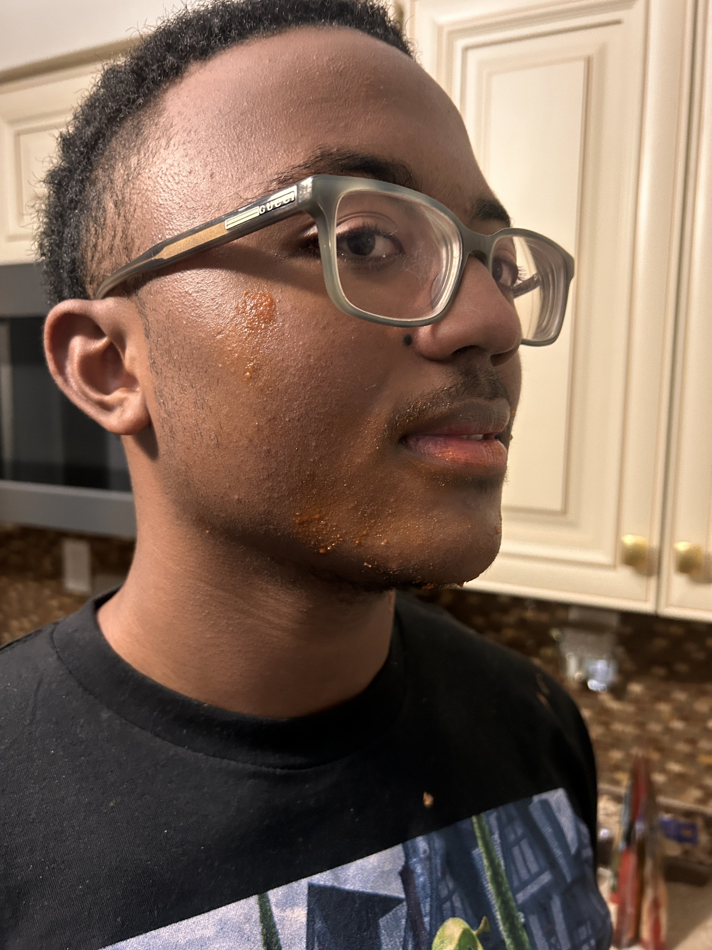 A young man wearing glasses with a sticky substance on his face, mostly on the cheek and chin area, in a kitchen with white cabinets.