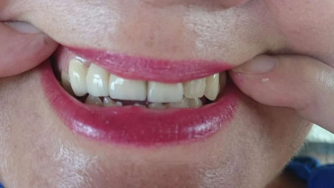 Damarias is READY to Smile