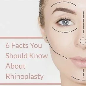 6 Facts You Need To Know About Rhinoplasty