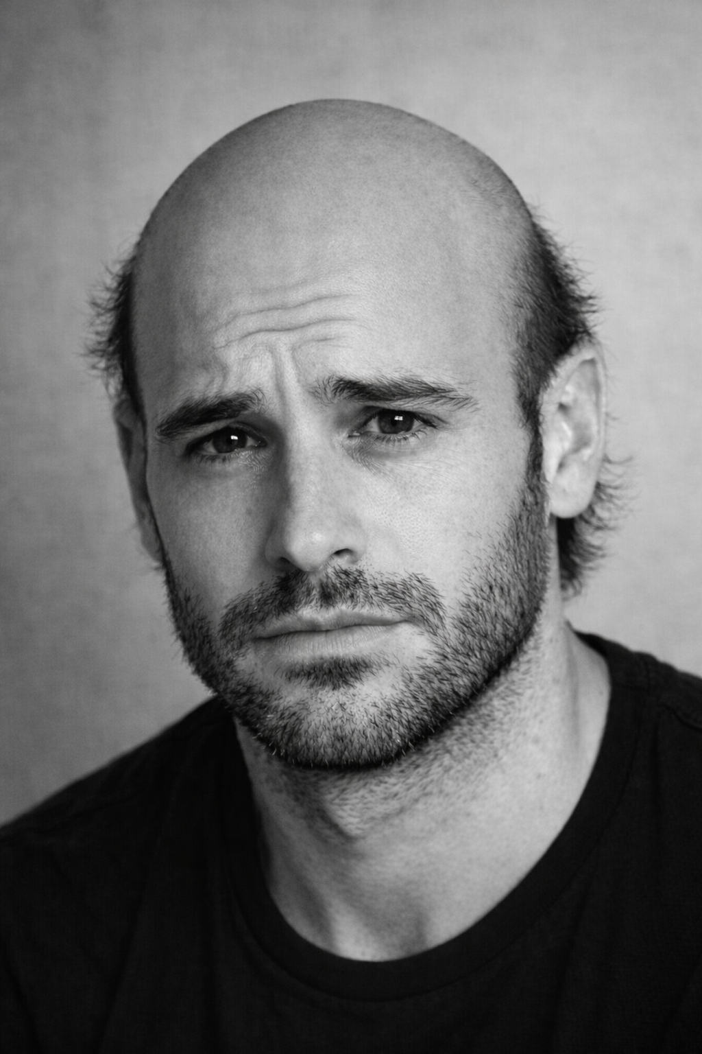 Ritratto in bianco e nero di un uomo con barba, calvo e senza capelli, che indossa una maglietta nera, con espressione triste e sguardo diretto verso la fotocamera.