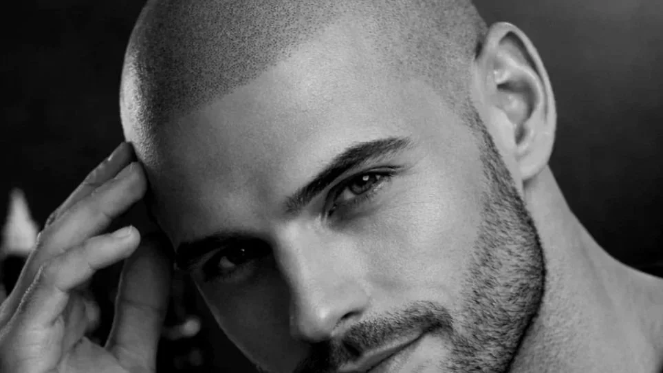 Ritratto di un uomo giovane con barba, sguardo intenso e un dito sulla tempia con testa rasata eseguita con tricopigmentazione