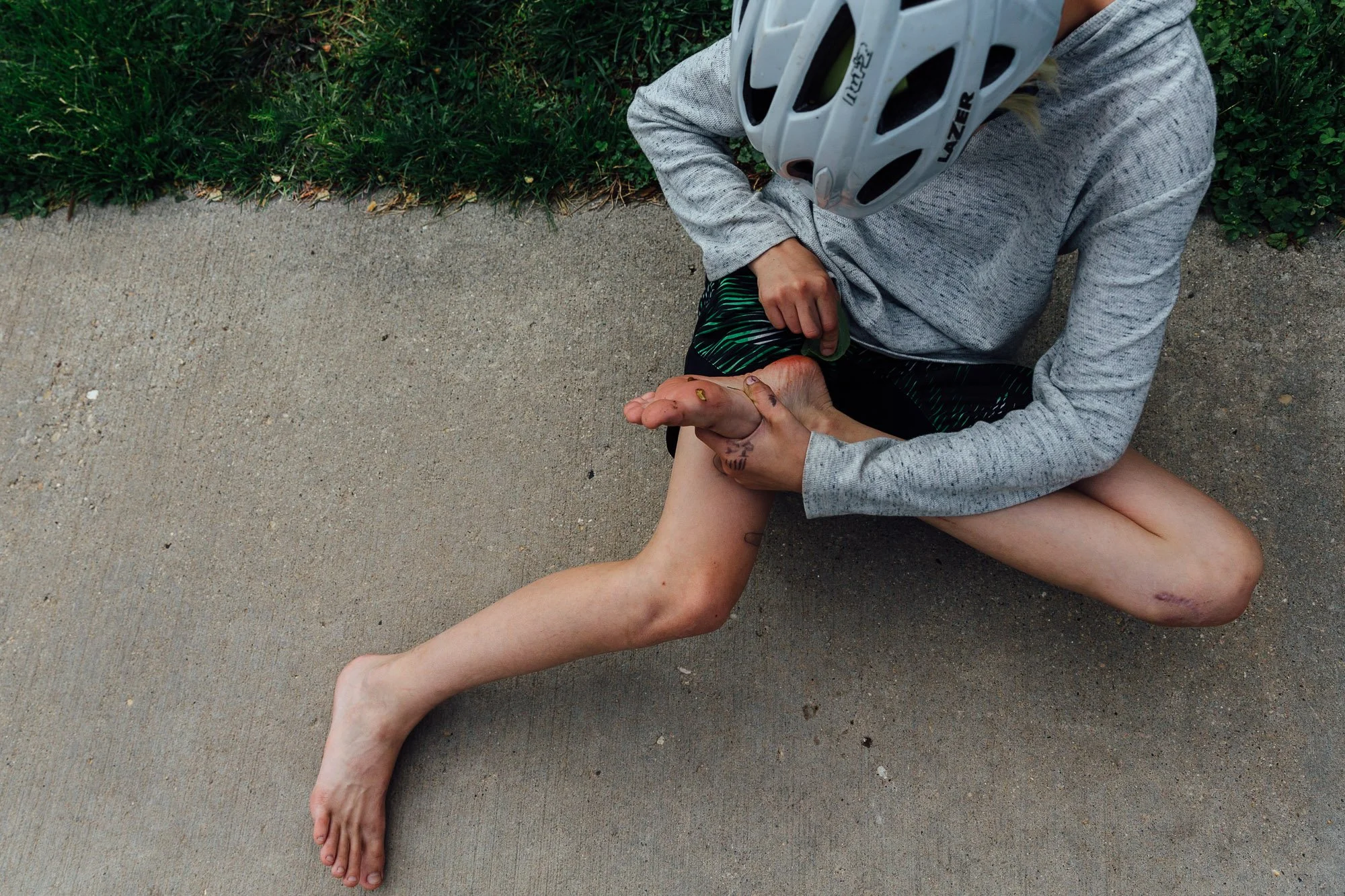 A person sitting on the ground with a bicycle helmet, appearing to be injured with scratches and bruises, clutching their leg and looking at bottom of foot.