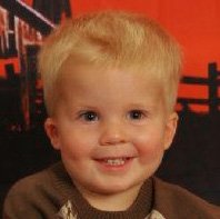 A toddler with blonde hair.  His right ear is smaller than his left.