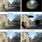 What is Glaucoma? Understanding the “Silent Thief of Sight”