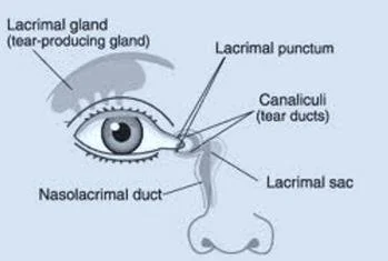 Punctal Occlusion: An Effective Treatment for Dry Eye