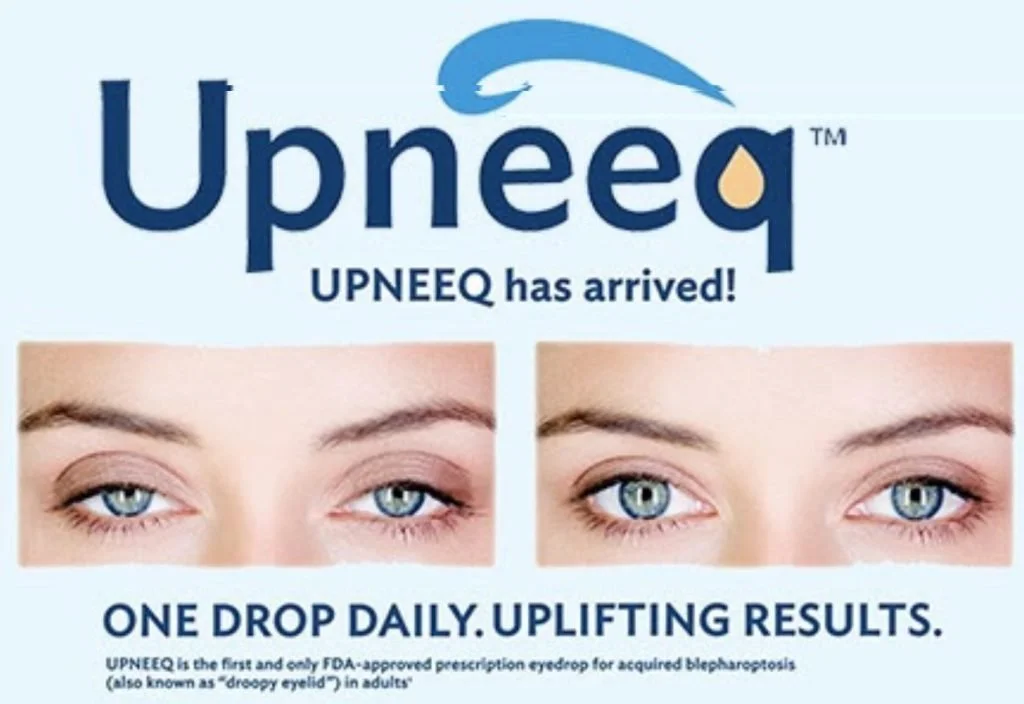 Say Goodbye to Droopy Lids with Upneeq